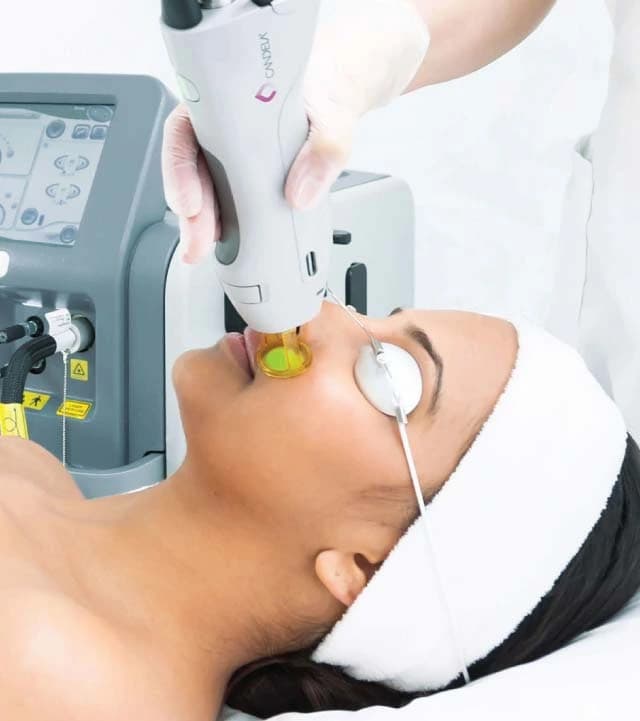 Laser Hair Removal